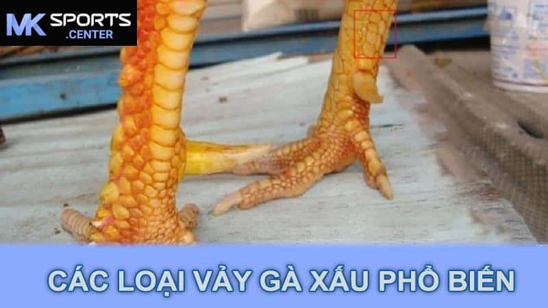 Các loại vảy gà xấu phổ biến